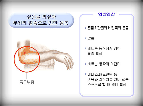 몸편한세상 이미지