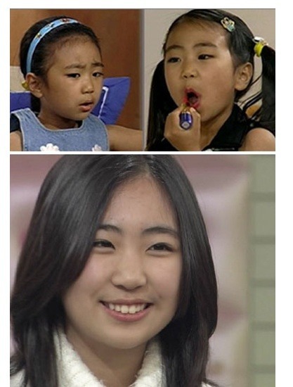 미달이 이미지