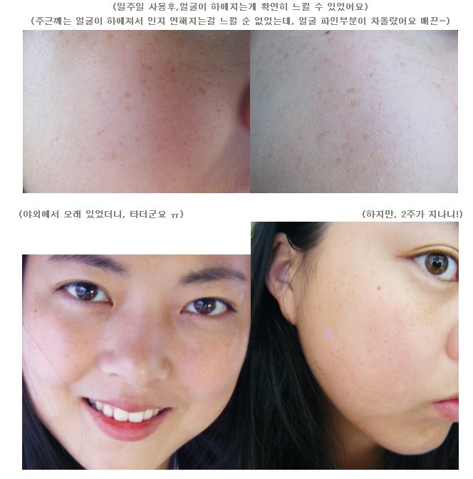 르네셀 이미지