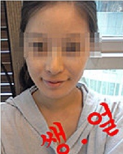 안면슈퍼 이미지