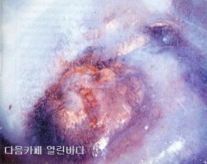 아이스맨 이미지