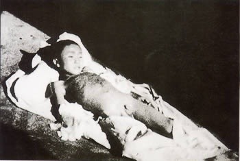 이들을 정말 같은 인간이라고 할수 있을까? (혐오주의) | 인스티즈