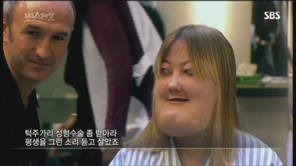 기형적 턱을 가진 여자 비키 라이트가 성형수술을 하지 않는 이유 | 인스티즈
