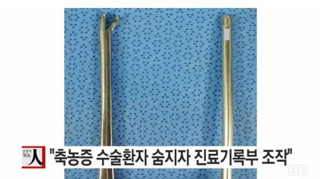 축농증 수술 환자 숨지자 의사가 진료기록부 조작 | 인스티즈