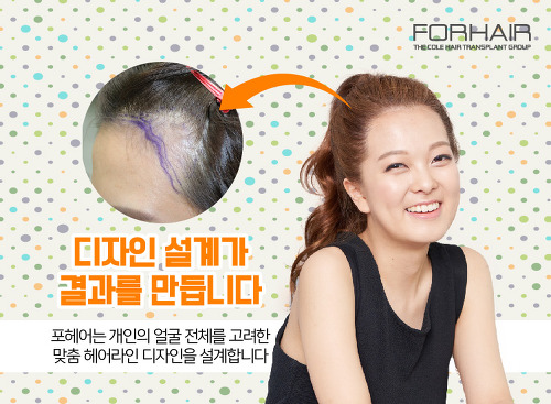 이미지헤어라인 이미지