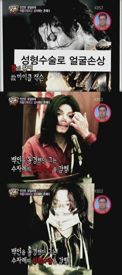 성형중독의 대명사가 되어버린 연예인 | 인스티즈