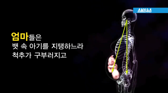 엄마들의 꺼내지 못한 이야기. 산후풍(産後風) | 인스티즈