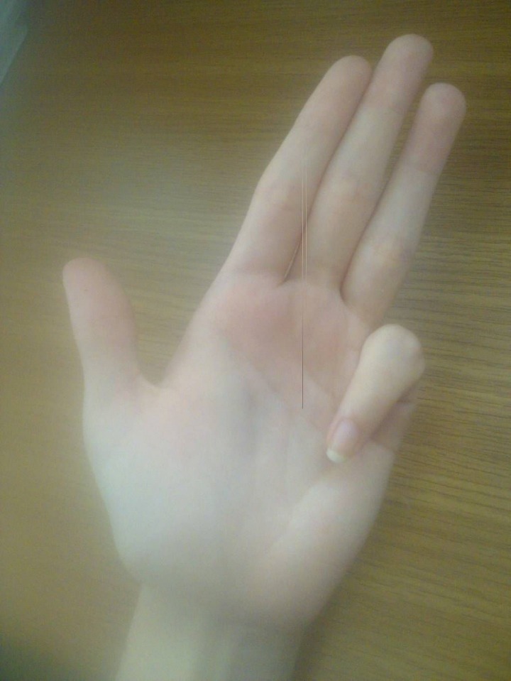 안 되는 사람들은 절대 안 된다는 손동작류 甲 .jpg | 인스티즈