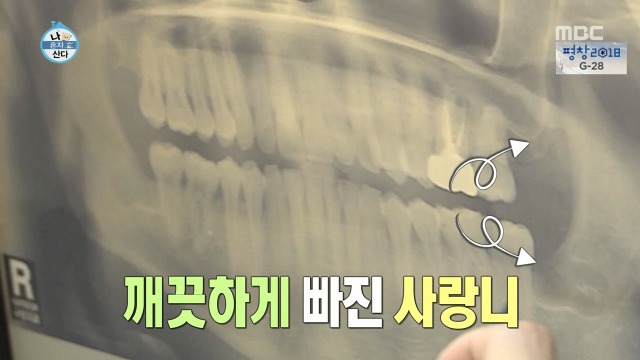 [나혼자산다] 너도나도 공감하는 공포의 사랑니 빼기 | 인스티즈