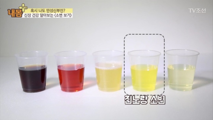 소변 색으로 보는 신장 건강 | 인스티즈