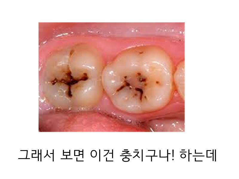 안녕하세오 치과의사에오 | 인스티즈